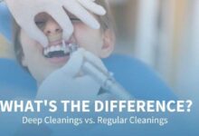 deep cleaning vs regular cleaning