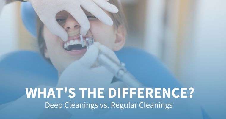 deep cleaning vs regular cleaning